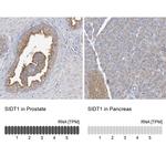 SIDT1 Antibody in Immunohistochemistry (IHC)