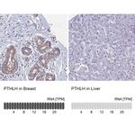 PTHLH Antibody