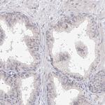 SLC7A7 Antibody in Immunohistochemistry (IHC)