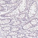 ZBBX Antibody in Immunohistochemistry (IHC)