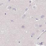 ZBBX Antibody in Immunohistochemistry (IHC)