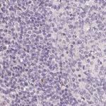 ZBBX Antibody in Immunohistochemistry (IHC)