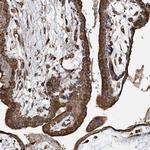 WDR12 Antibody in Immunohistochemistry (IHC)