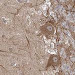 LRP130 Antibody in Immunohistochemistry (IHC)