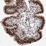 MATR3 Antibody in Immunohistochemistry (Paraffin) (IHC (P))