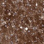 UGDH Antibody in Immunohistochemistry (IHC)