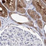 UGDH Antibody in Immunohistochemistry (IHC)