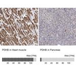 PDHB Antibody in Immunohistochemistry (IHC)