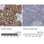 AGXT2 Antibody