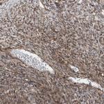 MCC Antibody in Immunohistochemistry (IHC)