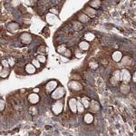 DDO Antibody in Immunohistochemistry (IHC)