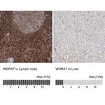 WDR37 Antibody in Immunohistochemistry (IHC)