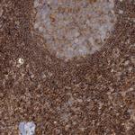 WDR37 Antibody in Immunohistochemistry (IHC)