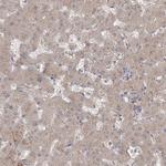 MPP7 Antibody in Immunohistochemistry (IHC)