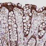 FCHO2 Antibody in Immunohistochemistry (IHC)