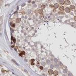 FCHO2 Antibody in Immunohistochemistry (IHC)