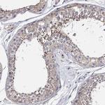 TTC40 Antibody in Immunohistochemistry (IHC)