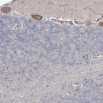 3BP5L Antibody in Immunohistochemistry (IHC)