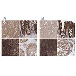 VPS37B Antibody in Immunohistochemistry (IHC)