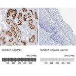 SLC3A1 Antibody in Immunohistochemistry (IHC)