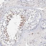 C6orf222 Antibody in Immunohistochemistry (Paraffin) (IHC (P))