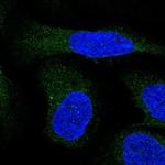 ALG9 Antibody in Immunocytochemistry (ICC/IF)