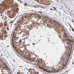 MTPAP Antibody in Immunohistochemistry (Paraffin) (IHC (P))