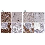 CLPB Antibody in Immunohistochemistry (IHC)