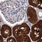 CLPB Antibody in Immunohistochemistry (IHC)