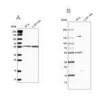 CLPB Antibody in Western Blot (WB)