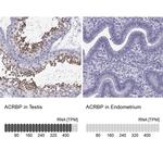 ACRBP Antibody in Immunohistochemistry (IHC)