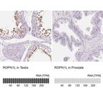 ROPN1L Antibody in Immunohistochemistry (IHC)