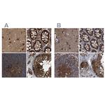 PEX5 Antibody in Immunohistochemistry (IHC)