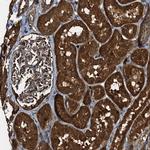 PEX5 Antibody in Immunohistochemistry (IHC)