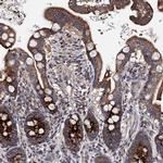 PPTC7 Antibody in Immunohistochemistry (IHC)