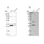 PPTC7 Antibody in Western Blot (WB)