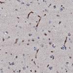 CLEC14A Antibody in Immunohistochemistry (Paraffin) (IHC (P))