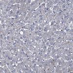 CLEC14A Antibody in Immunohistochemistry (Paraffin) (IHC (P))