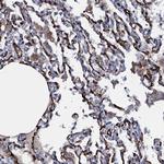 CLEC14A Antibody in Immunohistochemistry (Paraffin) (IHC (P))