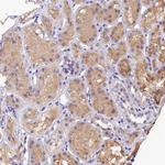 DGKH Antibody in Immunohistochemistry (Paraffin) (IHC (P))