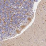 FAM149B1 Antibody in Immunohistochemistry (Paraffin) (IHC (P))