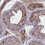 FAM149B1 Antibody in Immunohistochemistry (Paraffin) (IHC (P))