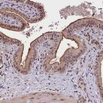 ATG101 Antibody in Immunohistochemistry (IHC)