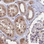 WDR61 Antibody in Immunohistochemistry (IHC)