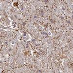 WDR61 Antibody in Immunohistochemistry (IHC)