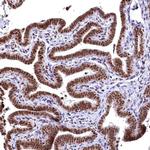 RSRC2 Antibody in Immunohistochemistry (IHC)