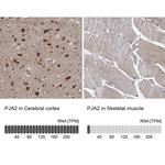 PJA2 Antibody in Immunohistochemistry (IHC)