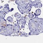 PLAC8 Antibody in Immunohistochemistry (IHC)