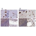 EEF1G Antibody in Immunohistochemistry (IHC)