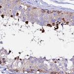 EEF1G Antibody in Immunohistochemistry (IHC)